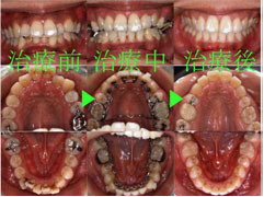 低料金を目指し矯正歯科へようこそ！